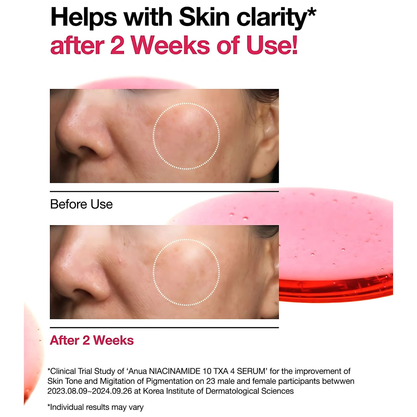 Anua Niacinamide 10% + TXA 4% Dark Spot Correcting Serum